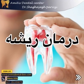 شرح درمان ریشه دندان بیمار