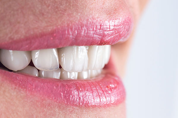 آیا دندان خراب یا پوسیده را میشود کامپوزیت کرد؟