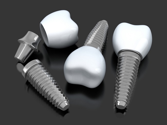 ایمپلنت دندان در پاسداران