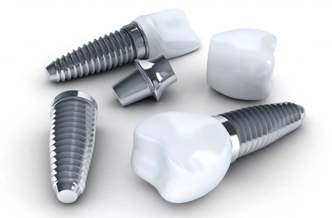 برندهای مختلف ایمپلنت دندان