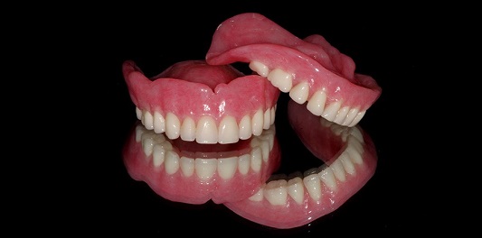مقایسه ایمپلنت دندان و دندان مصنوعی