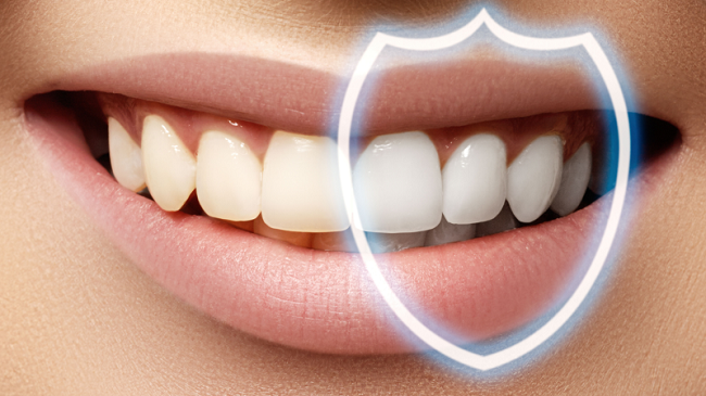 بررسی مزایا و معایب لمینت دندان