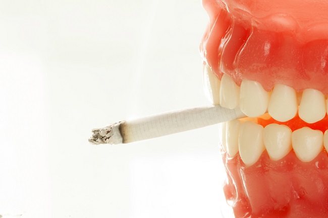 اثرات سیگار روی لمینت دندان